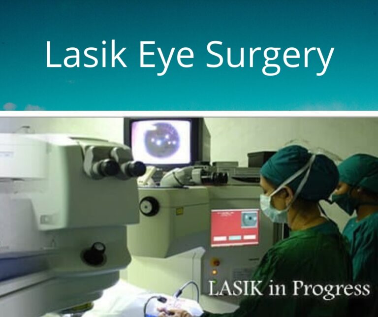 Lasik eye surgery 1 768x644