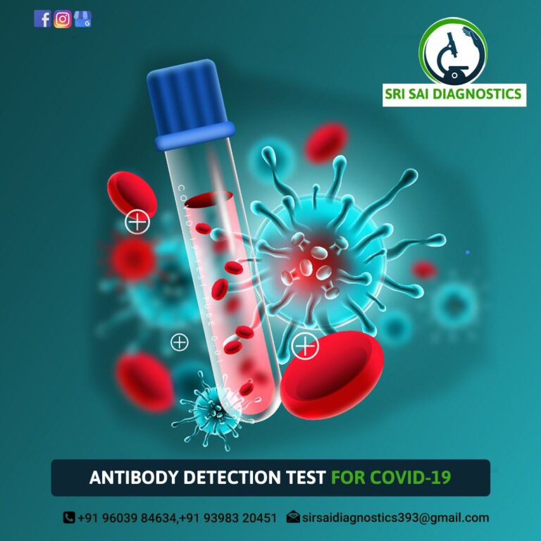 c21db10b 3aa4 408a 8236 208c0a41edb1 768x768