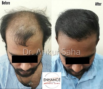 Hair Loss BA 10.b793c3050bbf31088073