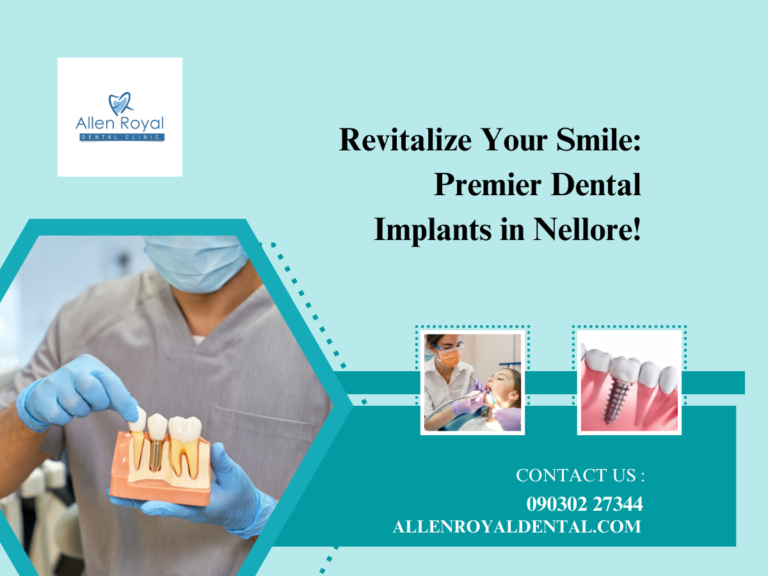 Revitalize your smile with implant treatment in Nellore 768x576