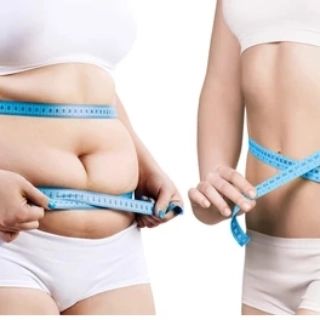 Weight Loss Treatment