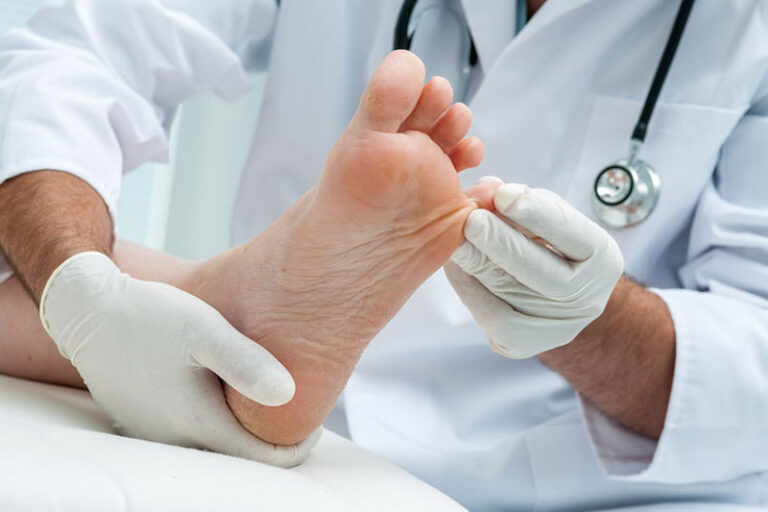 diabetic foot20190111212424708 768x512
