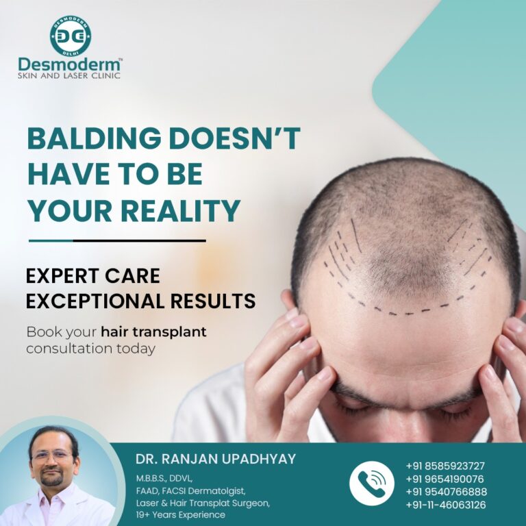 hair transplant in delhi desmoderm 768x768