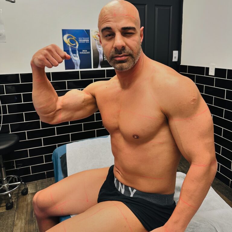 Effective Mens Fullbody Hair Removal in Sydney 768x768