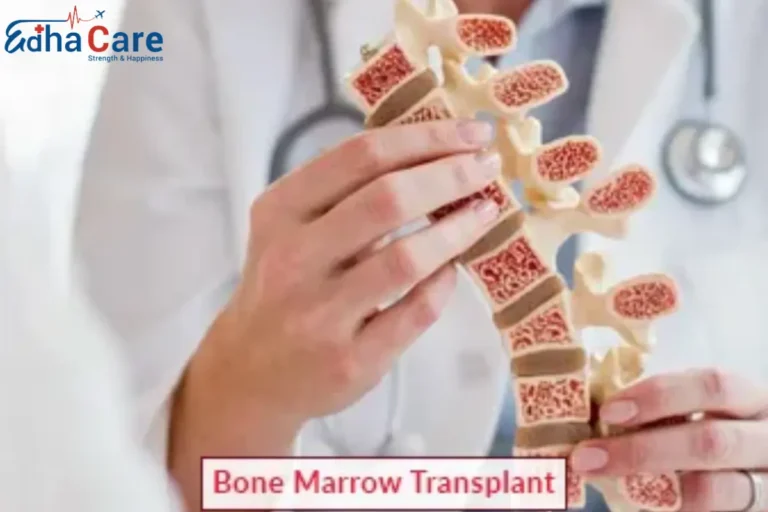 1720068763bone marrow 1 1 768x512