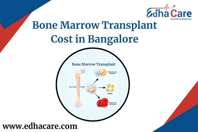 28916204d613e9acfcbbd4ac1e253094d19a518a8db127 768x512