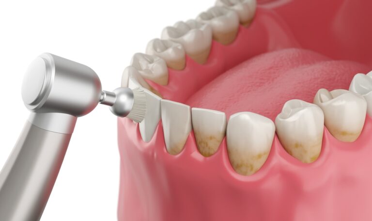 Dental Treatment 8 768x456