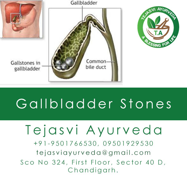 Dr Mrinalini Gupta Ayurvedic Treatment Gallbladder stones