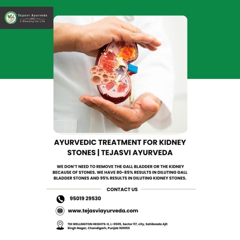 Dr Mrinalini Gupta kidney stones 768x768