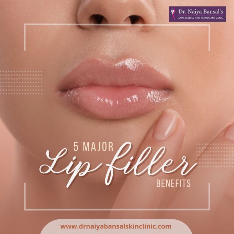 Dr Naiya bansal Lip filler treatment in Mohali 768x768