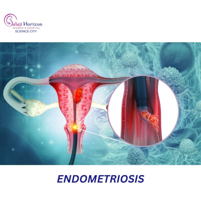 Endometriosis offpage image 16 5 25 768x768