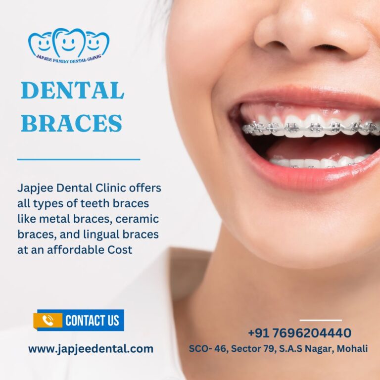 Japjee Family Dental Clinic Best dental clinic in Mohali Chandigarh 768x768