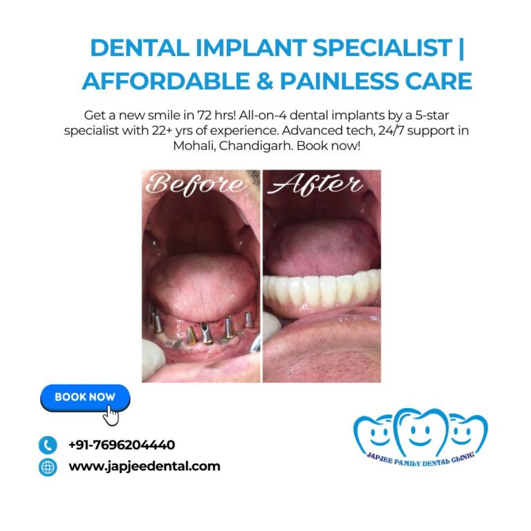 Japjee Family Dental Clinic Dental Implant Specialist in Mohali 768x768