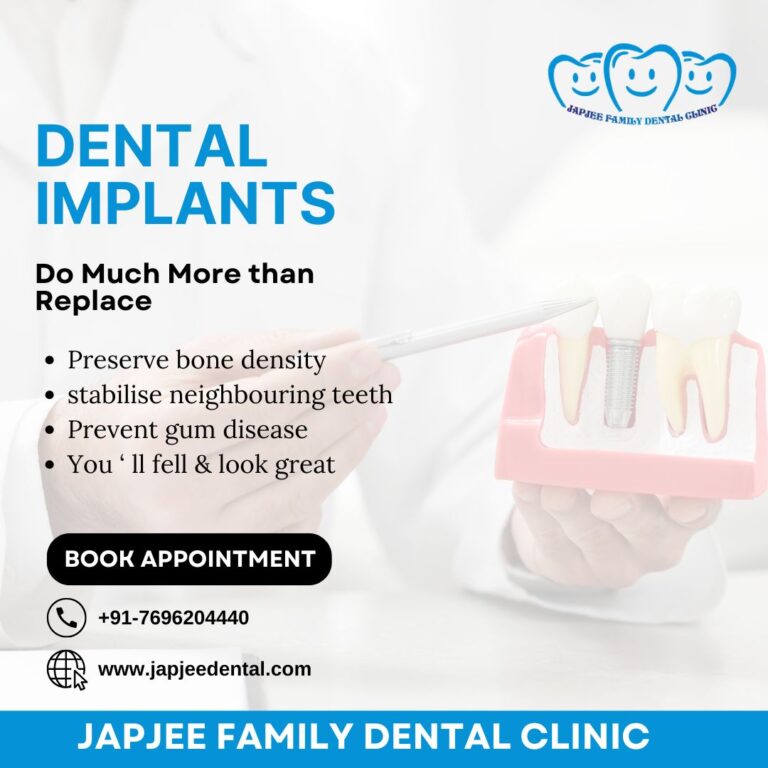 Japjee Family Dental Clinic Dental Implants in Mohali 768x768