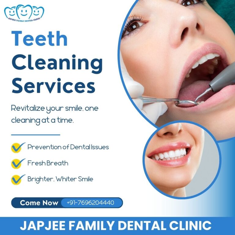 Japjee Family Dental Clinic Dentist in Mohali 9 768x768