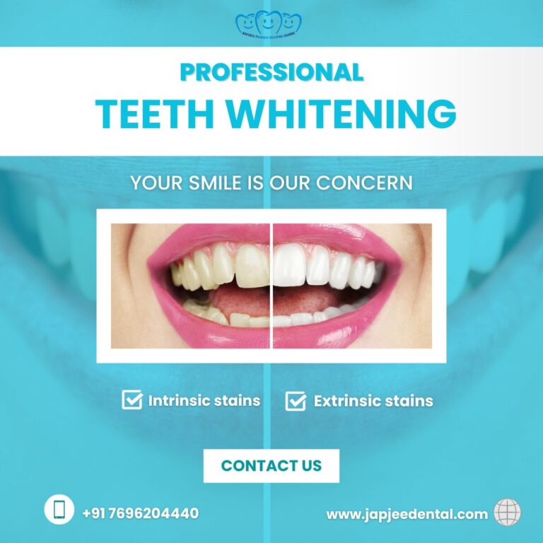 Japjee Family Dental Clinic Teeth whitening treatment in Mohali 8 768x768