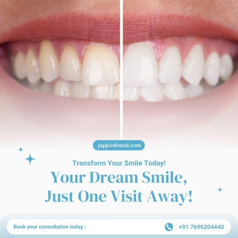 Japjee Family Dental Clinic in Mohali 20 768x768