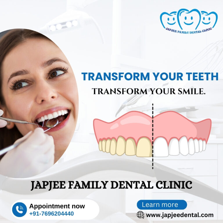 Japjee Family Dental Clinic in Mohali 6 768x768