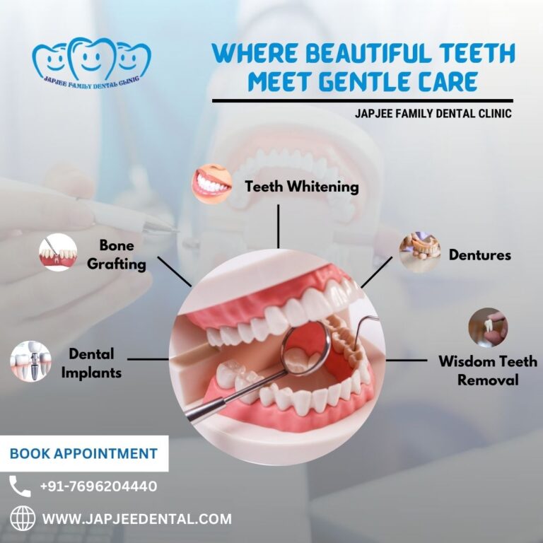 Japjee Family Dental Clinic in Mohali 768x768