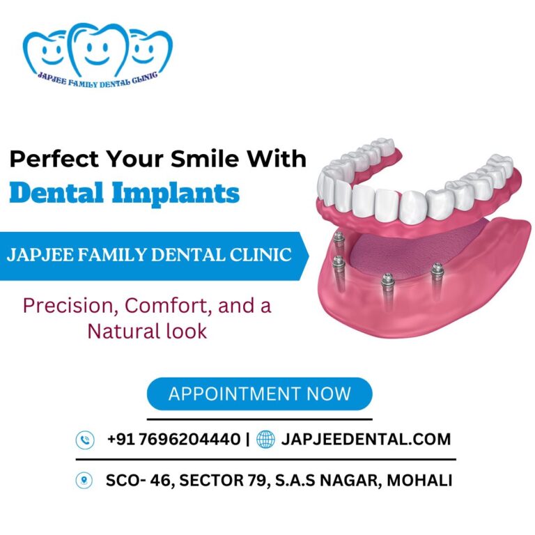 Japjee Family Dental Implants Mohali 768x768