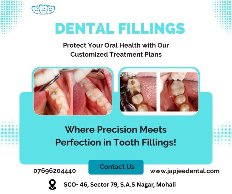 Japjee Family dental clinic Dentist in Mohali 12 768x644