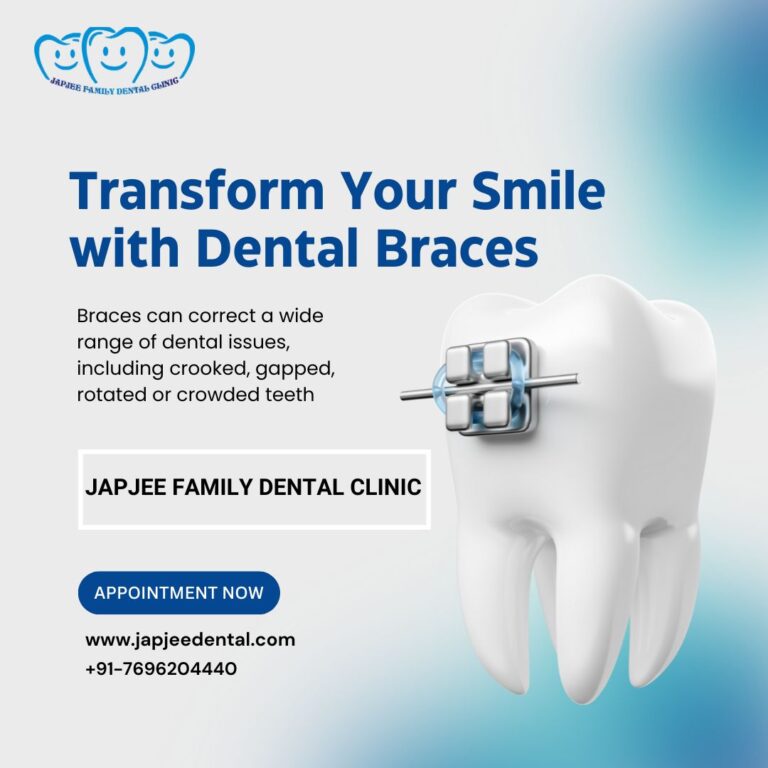 Japjee family dental clinic Braces for teeth in Mohali 768x768