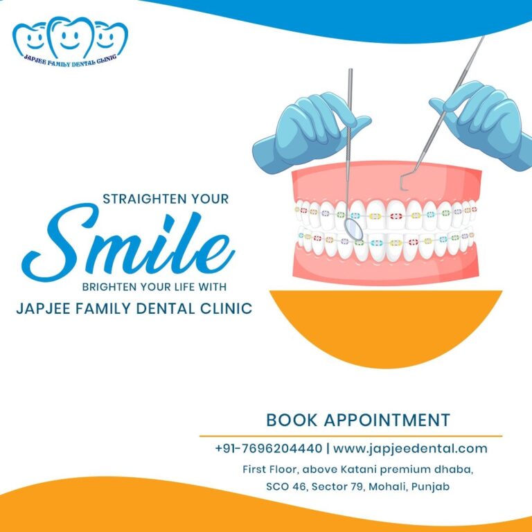 Japjee family dental clinic Mohali 2 768x768