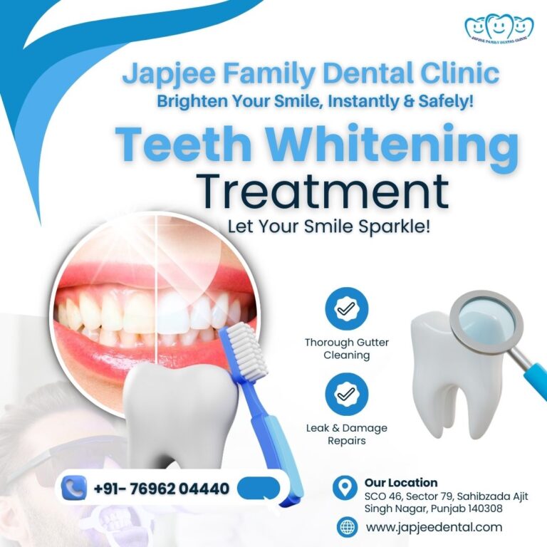 Japjee family dental clinic Teeth whitening treatment in Chandigarh 768x768