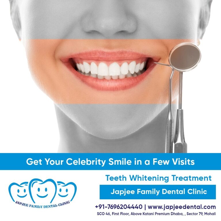 Teeth whitening treatment in Mohali 768x768