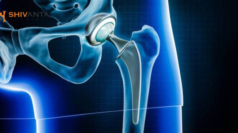 hip replacement offpage image 21 5 25 768x432