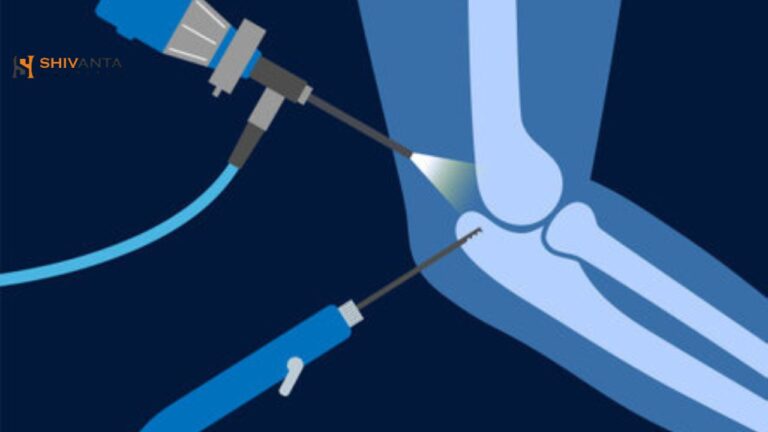 Arthroscopic Surgery offpage image 10 6 25 768x432