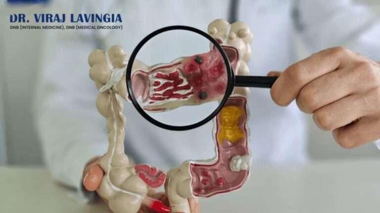 colorectal cancer offpage image 17 6 25 768x432