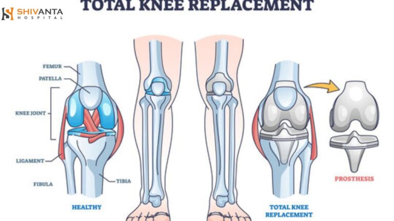 knee replacement offpage image 27 5 25 768x432
