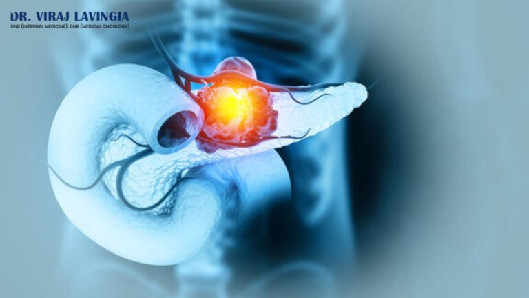 pancreatic cancer offpage image 10 6 25 768x432