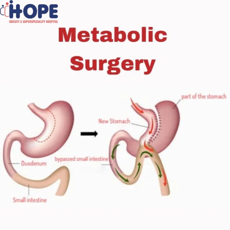 metabolic surgery offpage image 7 7 25 768x768