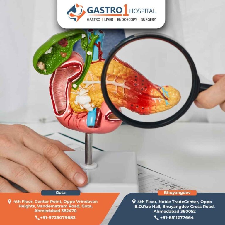 Acute Pancreatitis Gastro1 Hospital 768x768