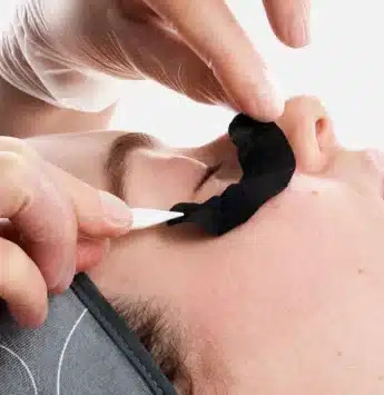 Dermalogica Eye Treatment Perth 345x355 1