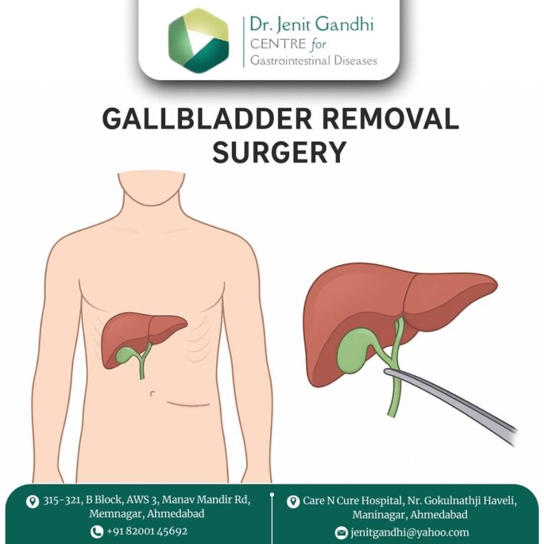 Gallblader Surgery Dr. Jenit Gandhi 768x768