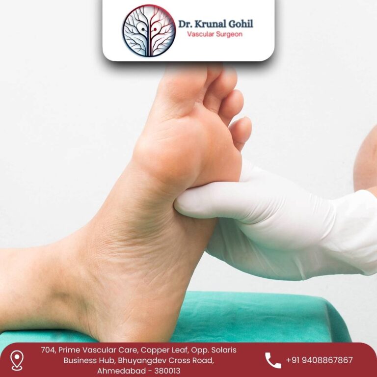 Gangrene Treatment Dr. Krunal Gohil 768x768