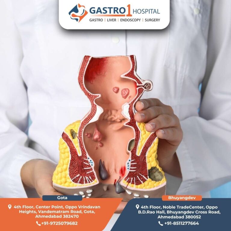 Gastro1 Hospital Fissure Doctor 1 768x768