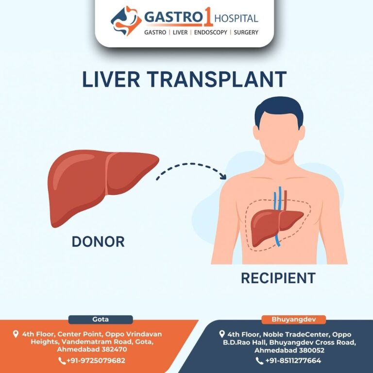 Liver Transplant Gastro1 Hospital 768x768
