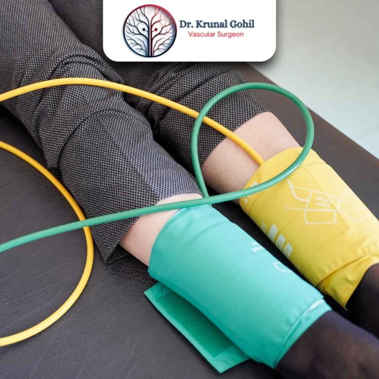Peripheral Arterial Disease Treatment Dr. Krunal Gohil 768x768