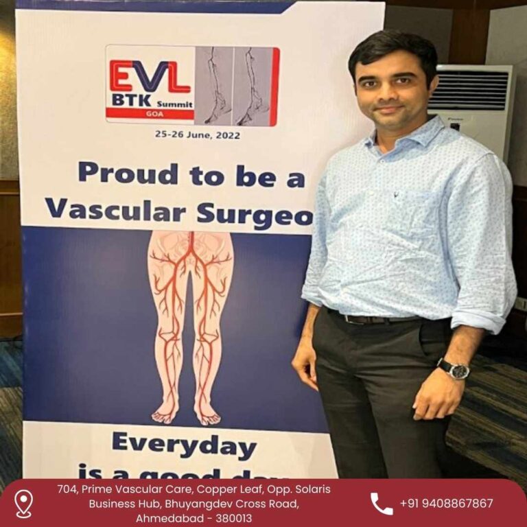 Varicose Veins Treatment Dr. Krunal Gohil 768x768