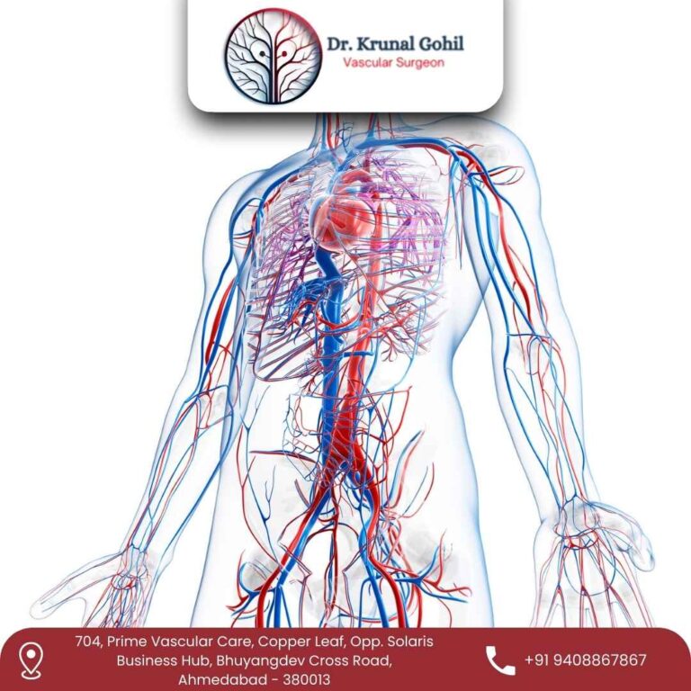 Vascular surgery Dr. Krunal Gohil 768x768