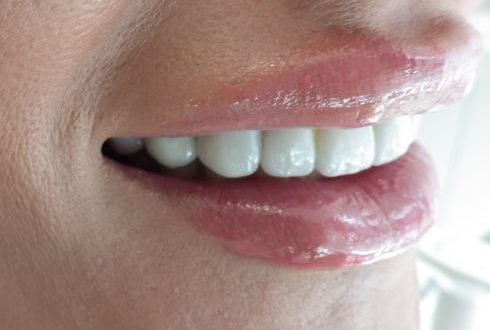 cosmetic dentist Adelaide
