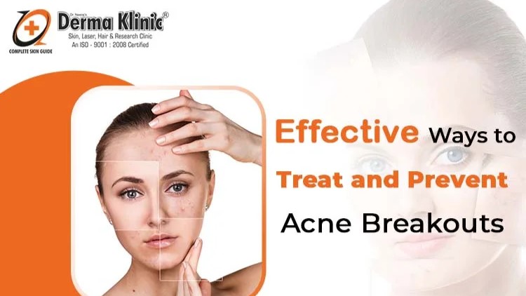 effective ways to treat and prevent acne breakouts at the derma klinic 1