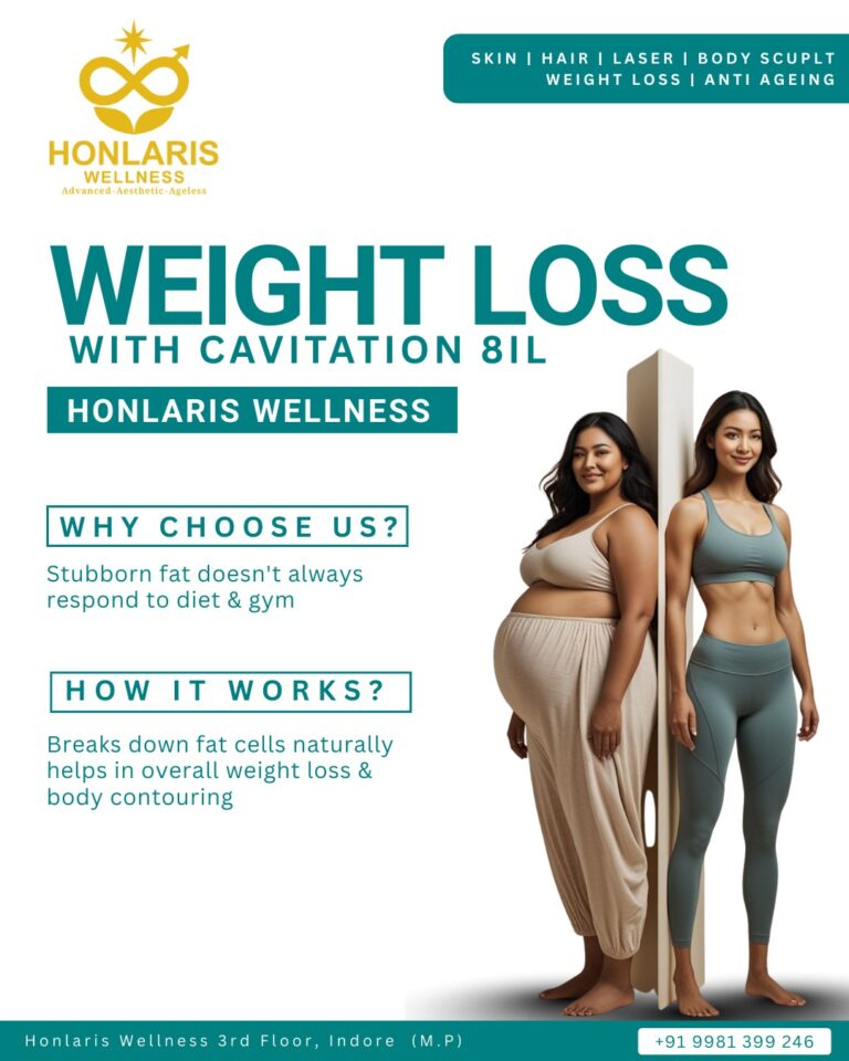 538633798 122129767970905179 2837306652187275055 n 768x960