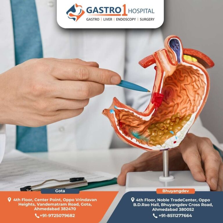 Best Gastroenterology Hospital in Ahmedabad Gastro1 Hospital 768x768