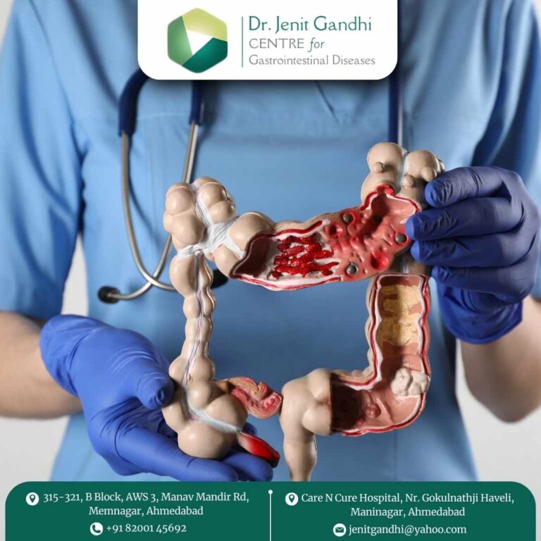 Colon Cancer Dr. Jenit Gandhi 768x768