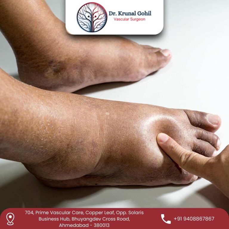 Diabetic Foot Dr. Krunal Gohil 768x768